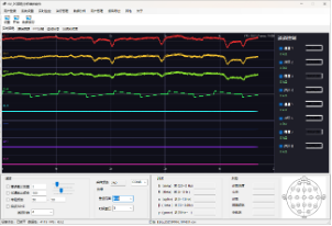 NV-PC2501 专业脑电分析软件